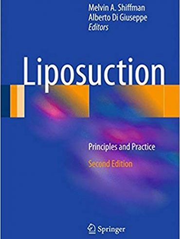 دانلود کتاب Liposuction: Principles and Practice 2nd Edition
