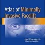دانلود کتاب Atlas of Minimally Invasive Facelift: Facial Rejuvenation with Volumetric Lipofilling 2017 Edition