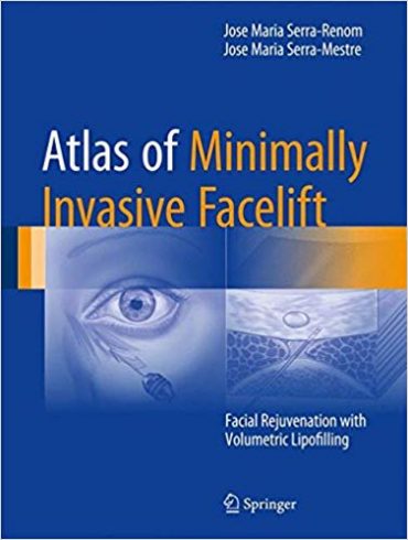 دانلود کتاب Atlas of Minimally Invasive Facelift: Facial Rejuvenation with Volumetric Lipofilling 2017 Edition