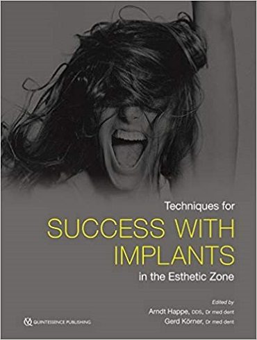 دانلود کتاب Techniques for Success With Implants in the Esthetic Zone