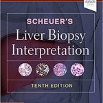 دانلود کتاب Scheuer’s Liver Biopsy Interpretation 10th Edition