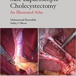 دانلود کتاب Safe Laparoscopic Cholecystectomy: An Illustrated Atlas 1st Edition