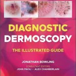 دانلود كتاب Diagnostic Dermoscopy: The Illustrated Guide 2nd Edition