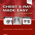 دانلود کتاب Chest X-Ray Made Easy 5th Edition