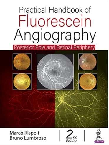 دانلود کتاب Practical Handbook of Fluorescein Angiography: Posterior Pole and Retinal Periphery 2nd Edition