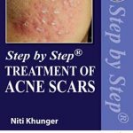 دانلود کتاب Step by Step Treatment of Acne Scars 2nd Edition