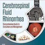 دانلود کتاب Cerebrospinal Fluid Rhinorrhea: Comprehensive Guide to Evaluation and Management 1st Edition