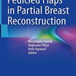 دانلود کتاب Pedicled Flaps in Partial Breast Reconstruction 1st Edition