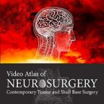 دانلود کتاب Video Atlas of Neurosurgery: Contemporary Tumor and Skull Base Surgery 1st Edition + Video