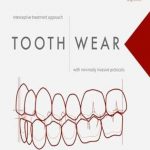 دانلود کتاب Tooth Wear: Interceptive Treatment Approach With Minimally Invasive Protocols 1st Edition