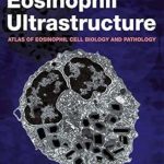 دانلود کتاب Eosinophil Ultrastructure: Atlas of Eosinophil Cell Biology and Pathology 1st Edition