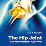 دانلود کتاب The Hip Joint: Modified Posterior Approach 1st Edition