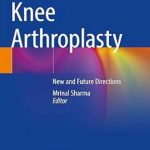 دانلود کتاب Knee Arthroplasty: New and Future Directions