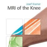 دانلود کتاب MRI of the Knee 1st Edition