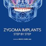 دانلود کتاب Zygoma Implants: Step by Step 1st Edition