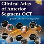 دانلود کتاب Clinical Atlas of Anterior Segment OCT: Optical Coherence Tomography 1st Edition