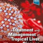 دانلود کتاب Treatment and Management of Tropical Liver Disease 1st Edition