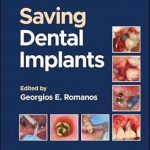 دانلود کتاب Saving Dental Implants 1st Edition