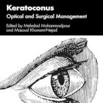 دانلود کتاب Keratoconus: Optical and Surgical Management 1st Edition