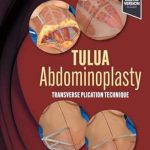 دانلود کتاب TULUA Abdominoplasty: Transverse Plication Technique 1st Edition