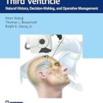 دانلود کتاب Colloid Cysts of the Third Ventricle: Natural History, Decision-Making, and Operative Management 1st Edition + Video
