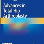 دانلود کتاب Advances in Total Hip Arthroplasty 1st Edition