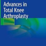 دانلود کتاب Advances in Total Knee Arthroplasty 1st Edition