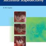 دانلود کتاب An Approach to Successful Stapedectomy 1st Edition