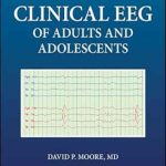 دانلود کتاب Clinical EEG of Adults and Adolescents 1st Edition