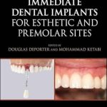 دانلود کتاب Immediate Dental Implants for Esthetic and Premolar Sites 1st Edition