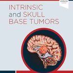دانلود کتاب Intrinsic and Skull Base Tumors: Neurosurgery: Case Management Comparison Series 1st Edition