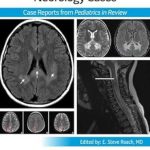 دانلود کتاب Pediatric Collections: Neurology Cases: Case Reports from Pediatrics in Review 1st Edition