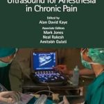 دانلود کتاب Practical Atlas of Ultrasound for Anesthesia in Chronic Pain 1st Edition