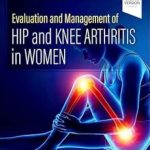 دانلود کتاب Evaluation and Management of Hip and Knee Arthritis in Women 1st Edition