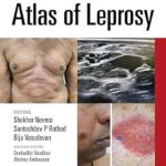 دانلود کتاب Atlas of Leprosy 1st Edition