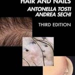 دانلود کتاب Dermoscopy of the Hair and Nails 3rd Edition