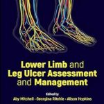 دانلود کتاب Lower Limb and Leg Ulcer Assessment and Management 1st Edition