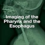 دانلود کتاب Imaging of the Pharynx and the Esophagus 1st Edition