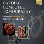دانلود کتاب Cardiac Computed Tomography: A Companion to Braunwald’s Heart Disease