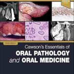دانلود کتاب Cawson’s Essentials of Oral Pathology and Oral Medicine 10th Edition