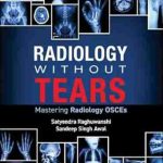 دانلود کتاب Radiology Without Tears: Mastering Radiology OSCEs 1st Edition