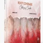 دانلود کتاب Root Coverage – Challenging Concepts 1st Edition