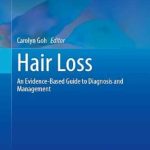 دانلود کتاب Hair Loss: An Evidence-Based Guide to Diagnosis and Management 1st Edition