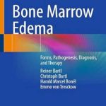 دانلود کتاب Bone Marrow Edema: Forms, Pathogenesis, Diagnosis, and Therapy 1st Edition